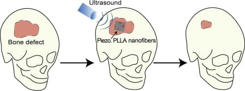 Biodegradable nanofiber bone-tissue scaffold as remotely-controlled and self-powering electrical stimulator