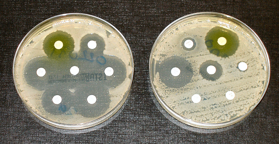 EMF bacteria how to test for antibiotic resistance