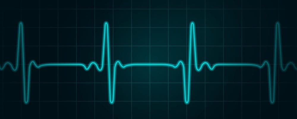 emf pacemakers heart rate