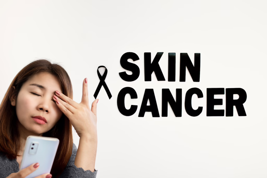 Electric EMF causes Skin Cancer